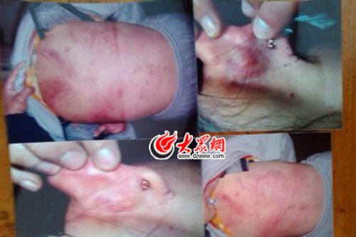 　山東藝術(shù)設(shè)計學(xué)院16歲女生宿舍內(nèi)被女同學(xué)暴打4小時。