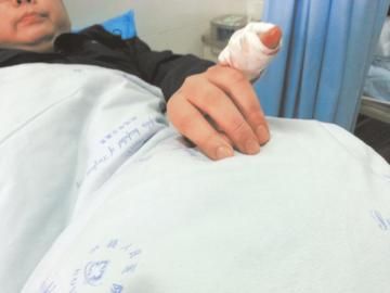 實習(xí)醫(yī)生陳洪左手的小拇指肌腱斷裂。